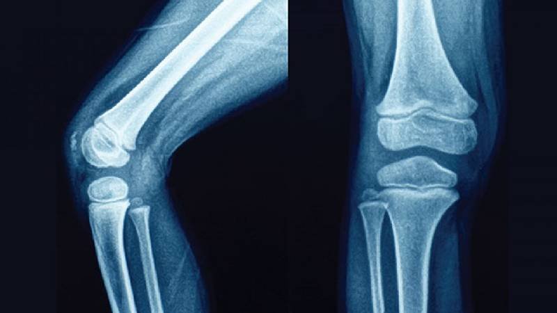 Joint/Bone Health